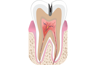 tooth1
